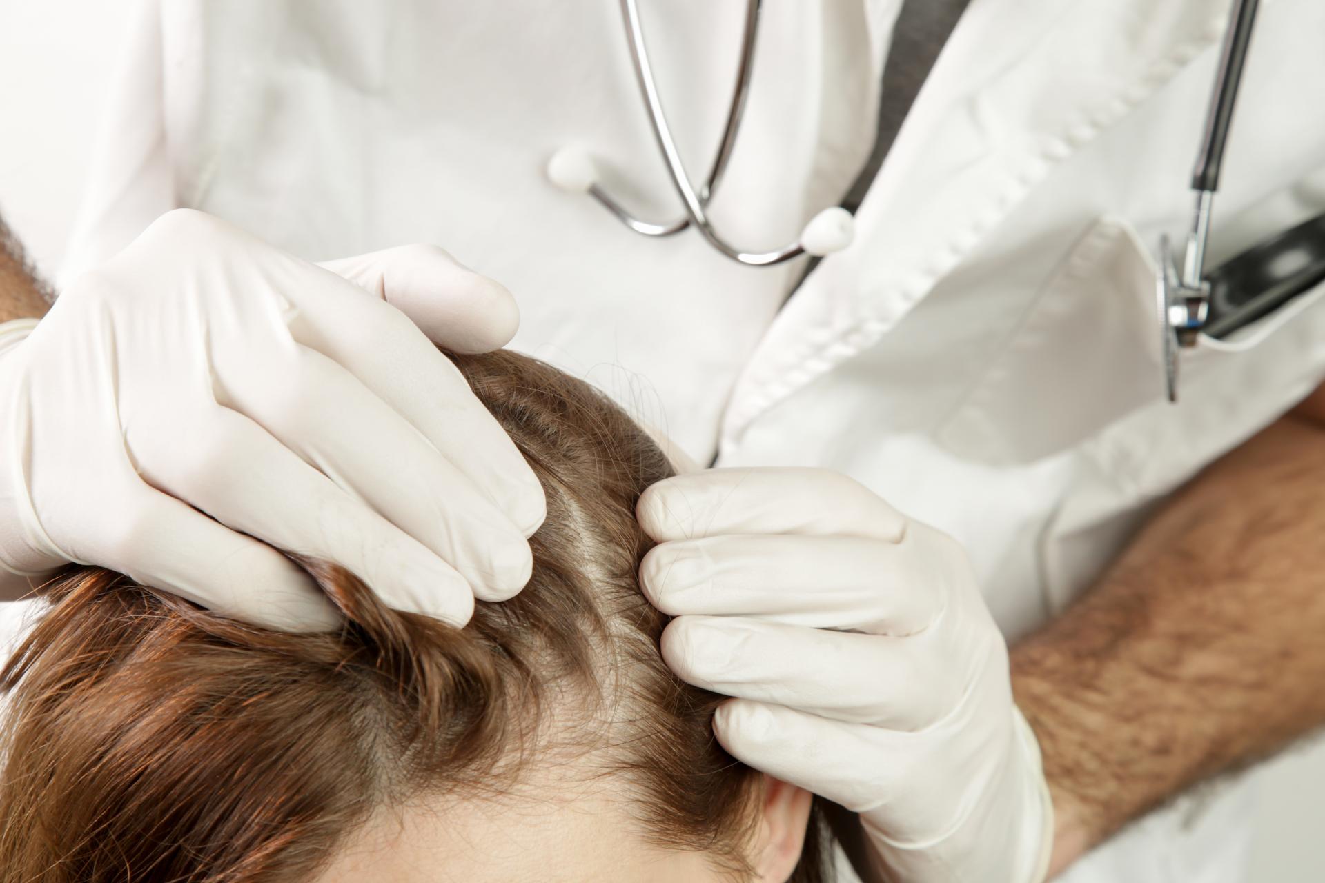 How to Care for Dry Scalp and Prevent Hair Breakage