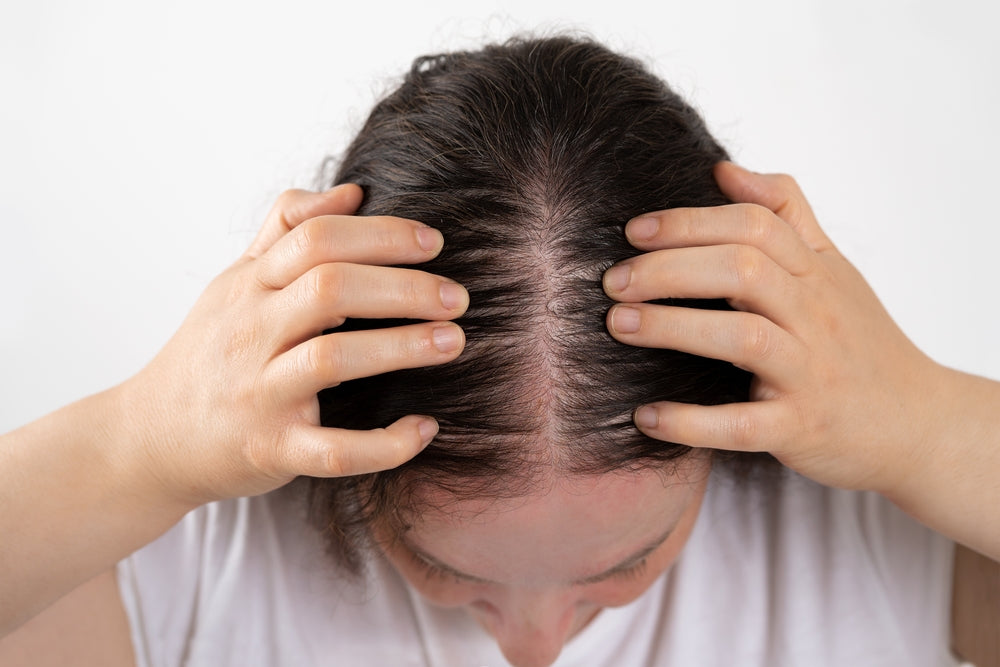 Losing Hair in Your 20s? Fix Your Scalp Care Now