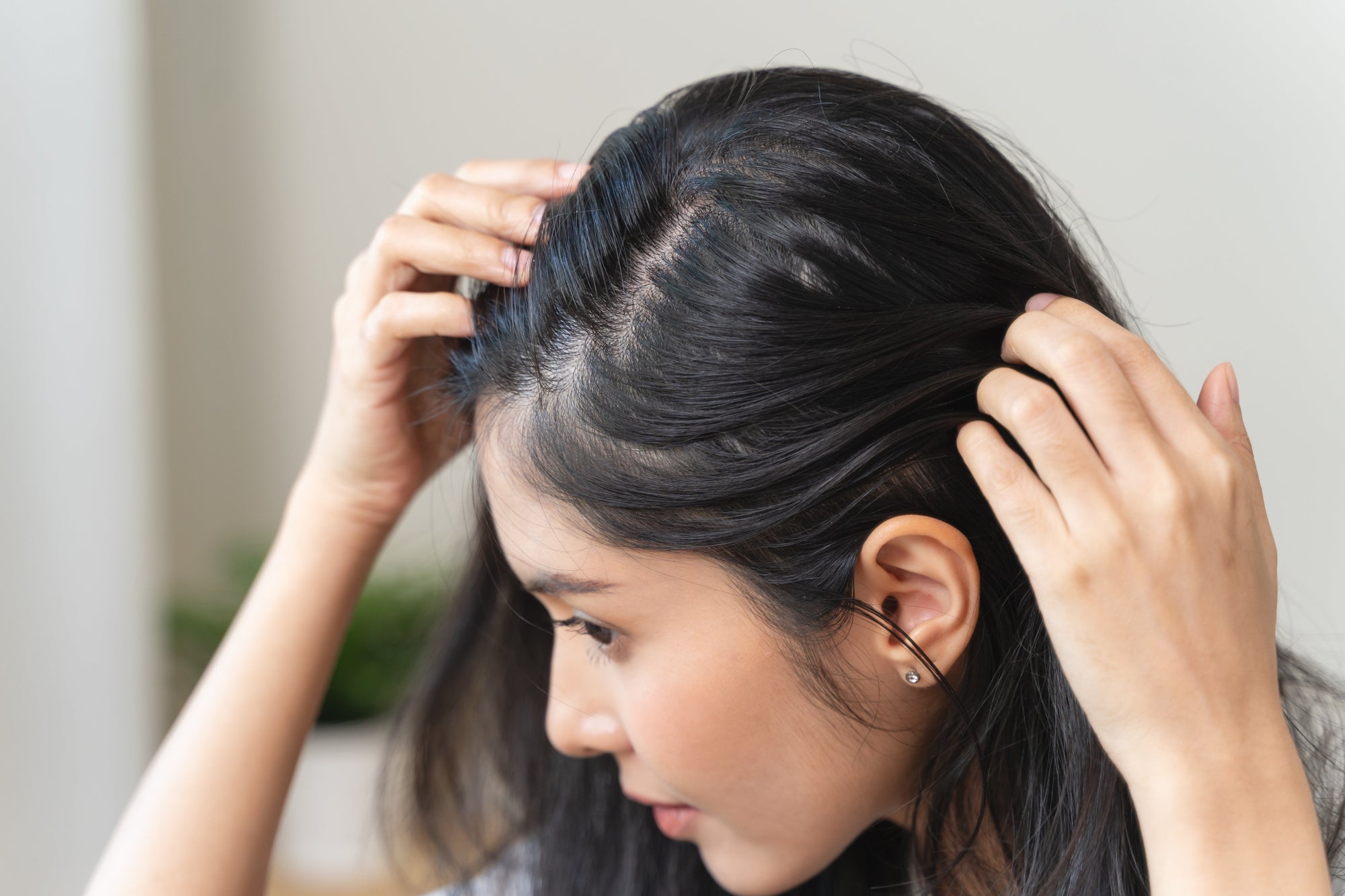 Spring Scalp Warning Signs — Why Itchy Scalp and Dandruff After Spring Can Lead to Hair Thinning